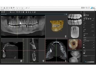 VistaSoft 3D Imaging Software Durr Dental